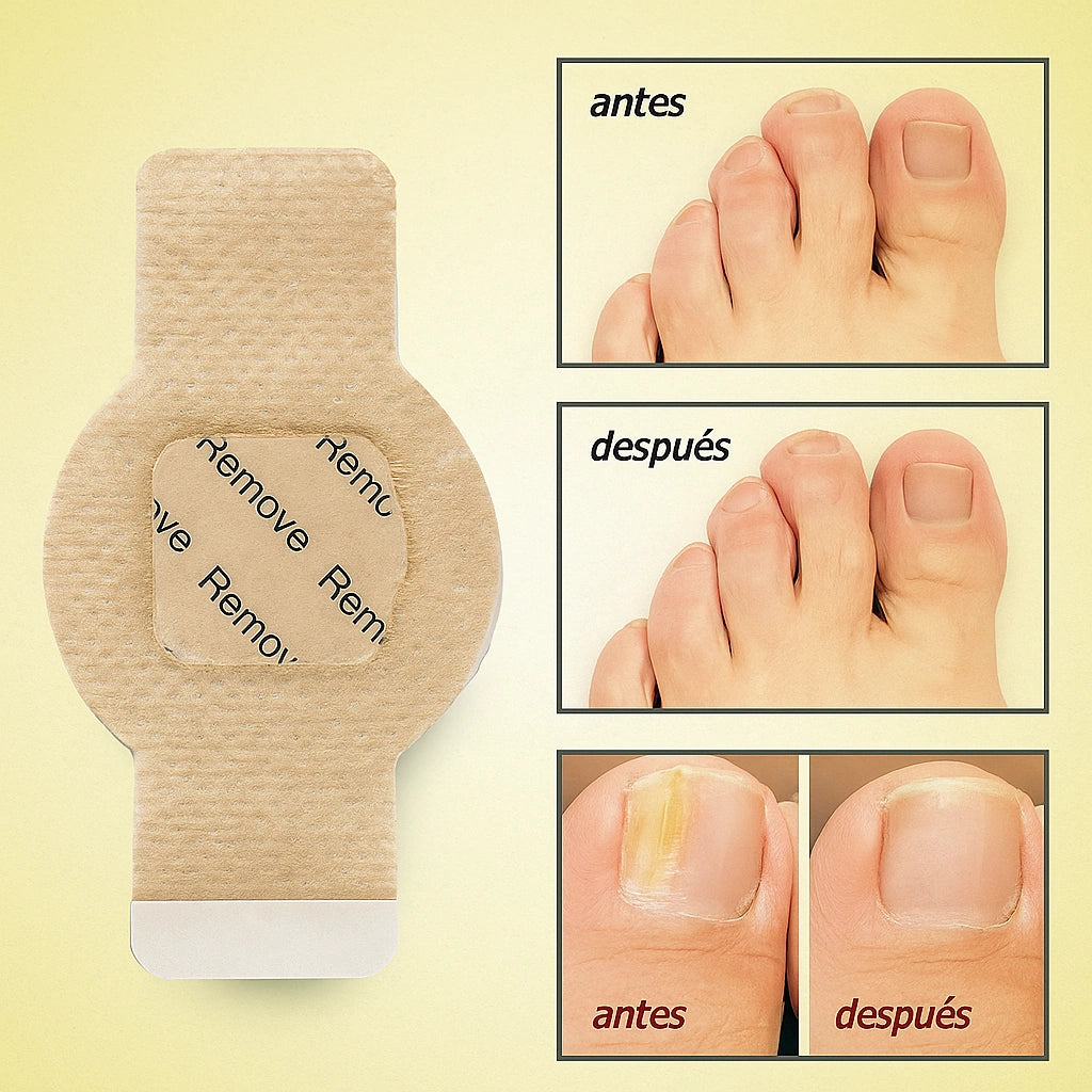 🦶 ¡OFERTA 2x1!  Tratamiento nocturno para el hongo de las uñas ¡Recupera su apariencia saludable!